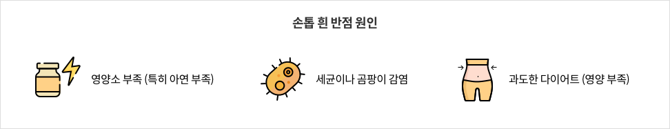 손톱 흰 반점 원인 : 영양소 부족 (특히 아연 부족), 세균이나 곰팡이 감염, 과도한 다이어트 (영양 부족)