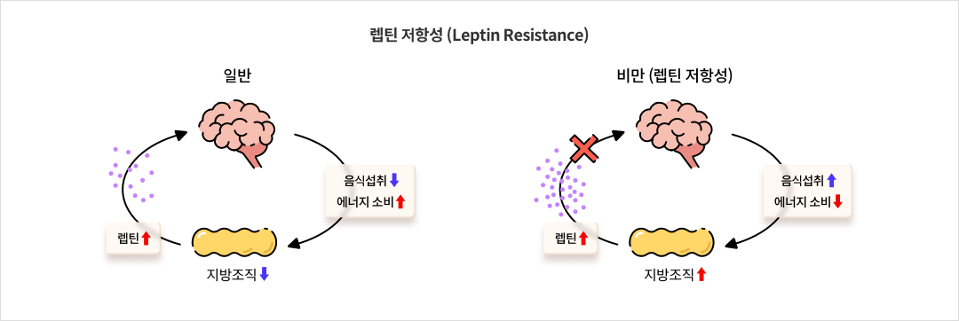 렙틴 저항성