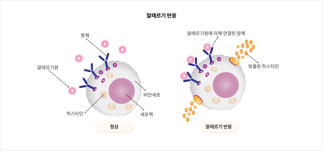 알레르기 반응