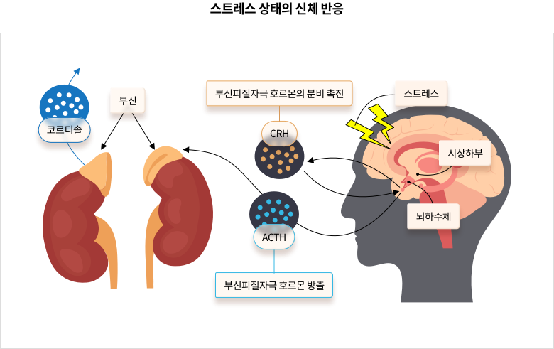 스트레스 상태의 신체 반응