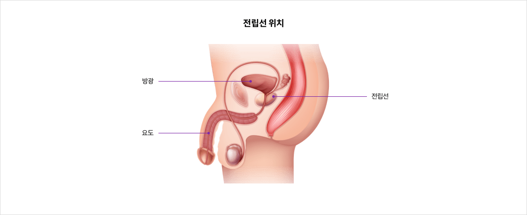 전립선 위치