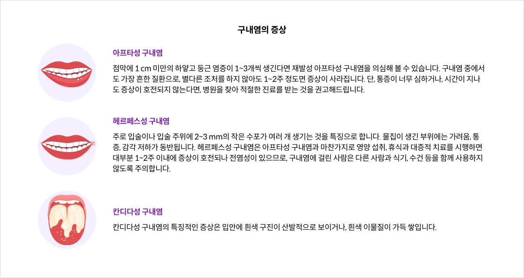 구내염의 증상