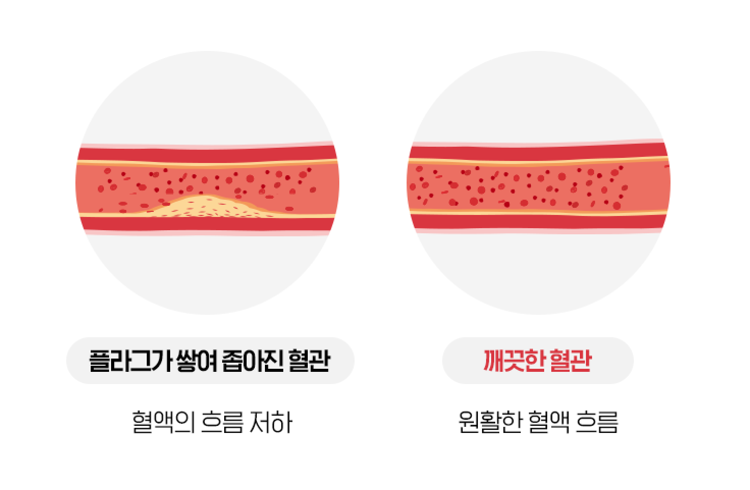 원활한 혈행 건강